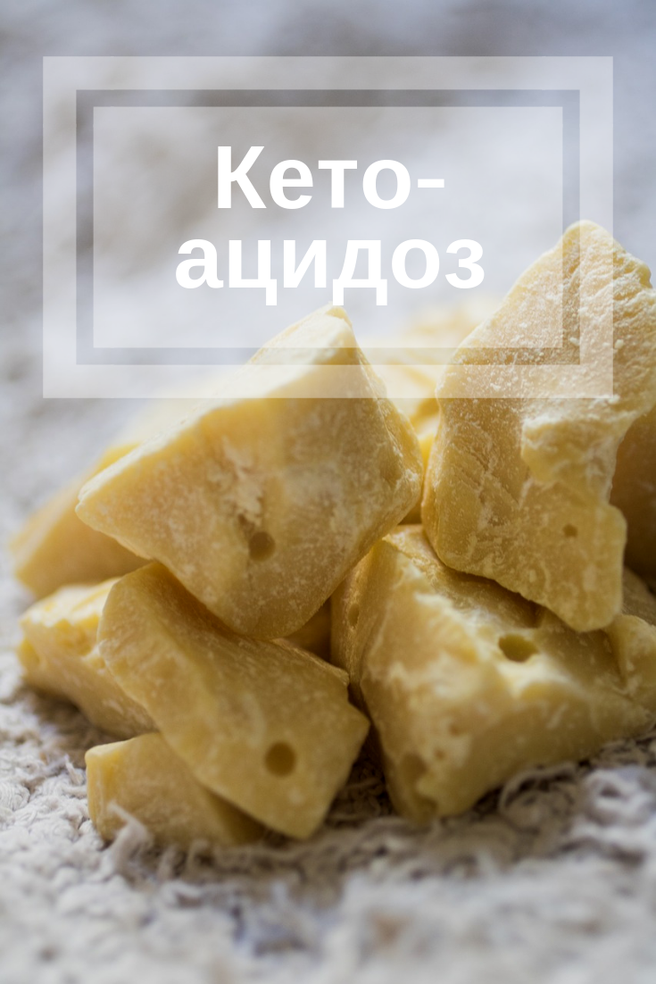 кетоацидоз